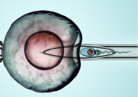 试管婴儿移植后怎么吃怎么保养卵巢