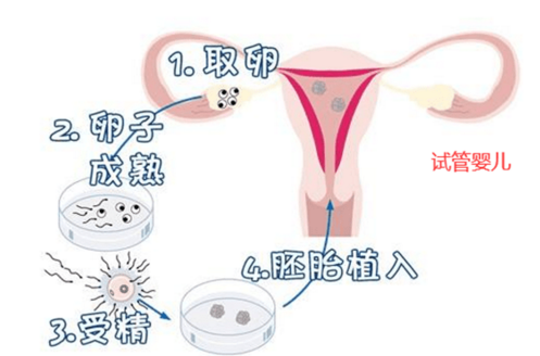 试管婴儿前需检查什么必须有健康的卵巢