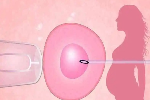 有宫寒的女性移植囊胚后需要注意哪些事项？