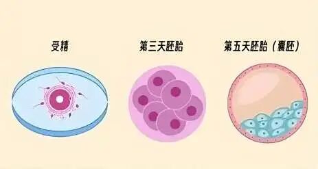 试管婴儿养囊还是不养囊？有什么区别？