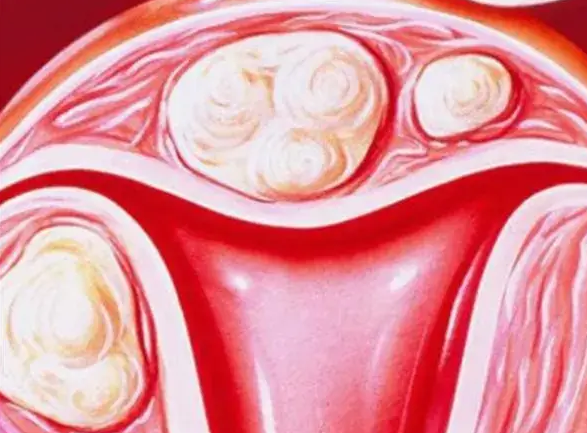 内膜薄调理多久能怀孕？关键看病因