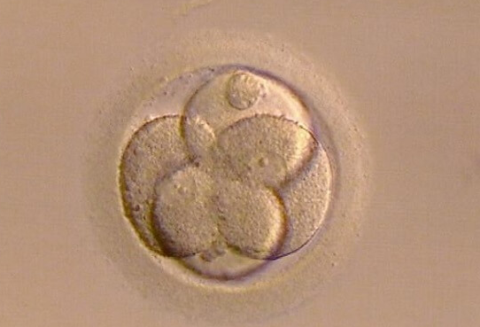 高龄养囊屡次失败：精卵质量与技术水平背后的深层原因