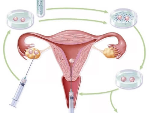 拮抗剂方案与内膜变薄：激素波动是核心诱因