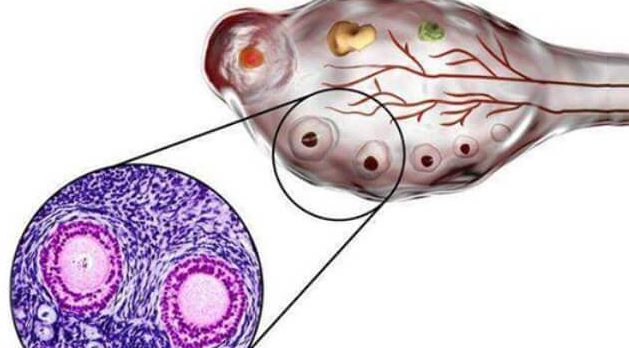 试管婴儿移植后为何需要补充黄体酮？