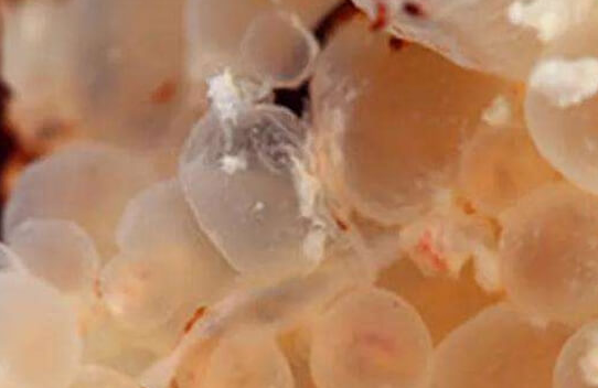 女性怀上葡萄胎的原因:内分泌、营养等可能因素