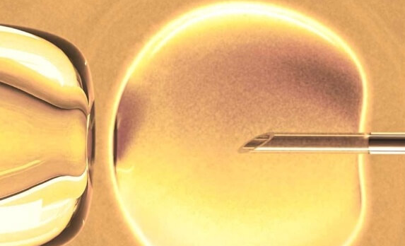 试管促排卵泡发育慢先别急，科学应对有方法