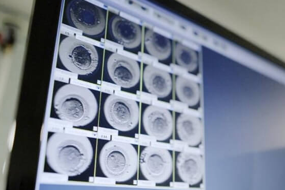 试管发育慢的胚胎会不会变好？弄清原因再解决是关键