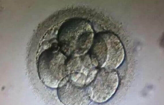 取卵后胚胎移植时间解析：鲜胚与冻胚的差异化安排