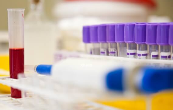 AMH值会随心情变化吗?解析其核心影响因素