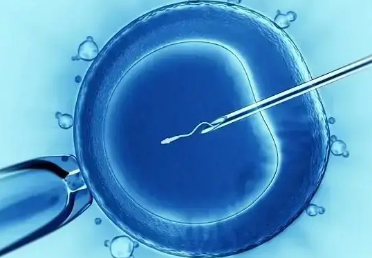 取卵后孕酮过高别慌,科学应对有方法