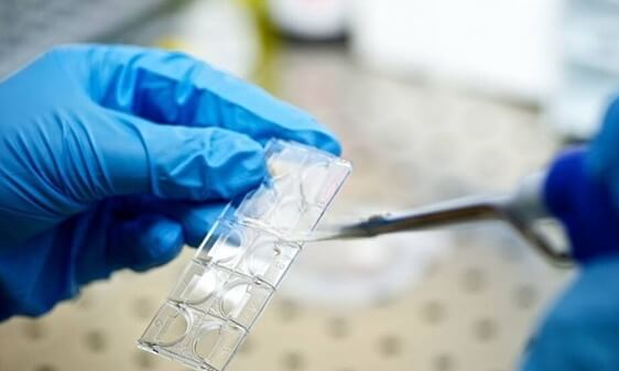 试管婴儿移植后孕酮低：子宫损伤与肥胖等关键因素解析