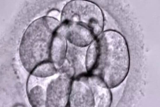 30+女性看过来！吉尔吉斯斯坦冻卵，开启生育自由新大门