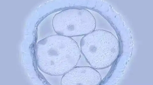 高龄女性试管婴儿合理备孕方法全解析