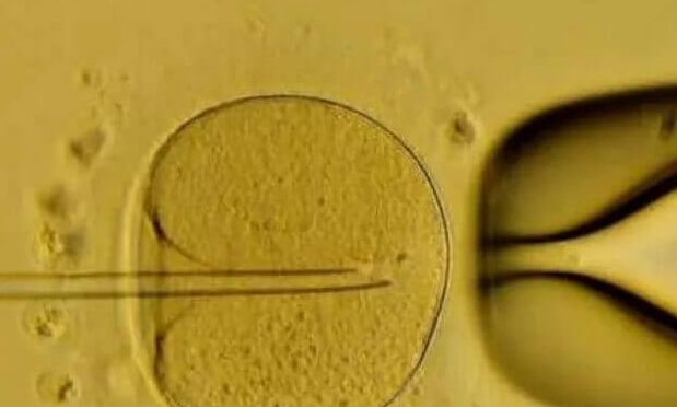 哪些人适合移植囊胚?优势解析助您科学选择