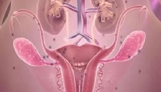 子宫内膜不均匀对胚胎着床的影响：四种需警惕的情况