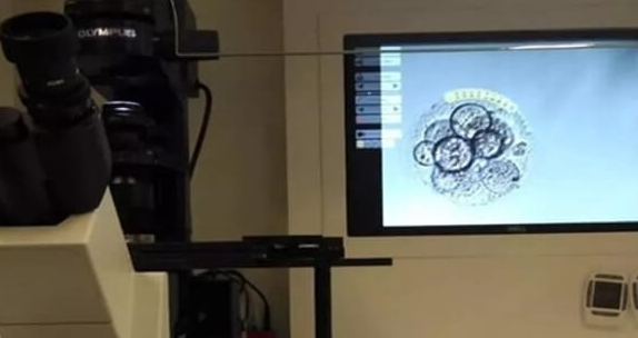 胚胎三级为何建议养囊？提前知这些关键优势