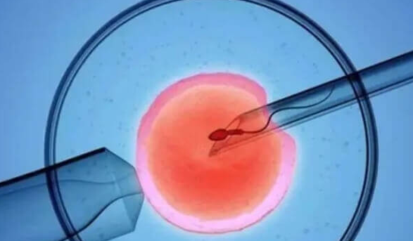 泰国试管婴儿：技术、服务与性价比的全方位优势解析