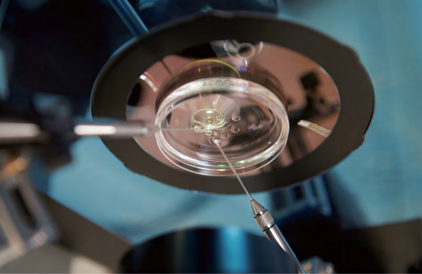 美国EFC试管婴儿技术优势：缔造生育奇迹的领导者