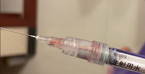 取卵后打思则凯有什么用？能否防止腹水？速速了解