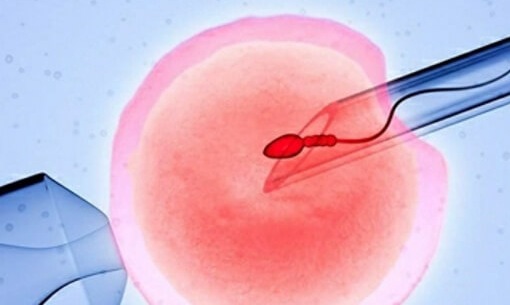 美国试管婴儿移植后胚胎着床的征兆