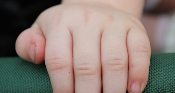 美国试管婴儿成功移植后的选择与决策