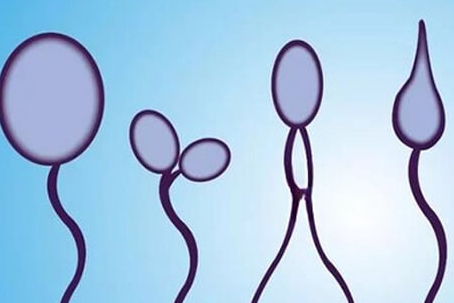 美国试管婴儿中的重要步骤：男性排精次数解析