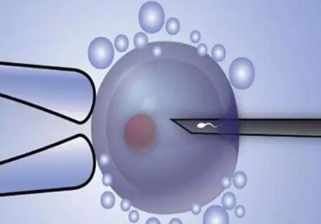 泰国三代试管婴儿成功后的关键检查指南