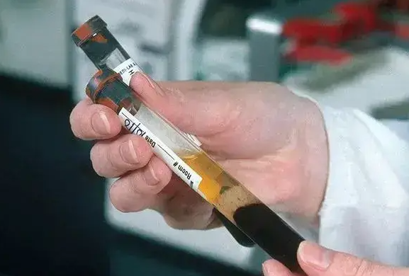 AMH 0.27做试管婴儿成功率分析及个体化方案希望