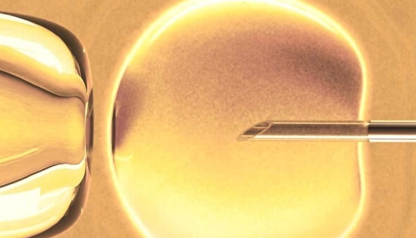 泰国试管促排期间注意事项盘点：定期监测与卫生管理是关键