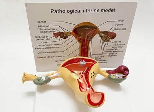 泰国千禧生殖中心：子宫畸形的6种类型汇总解析