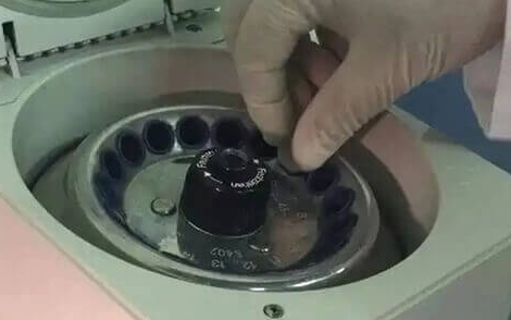 人工受孕中精子的挑选与优化：方法、原理及流程