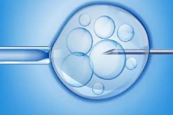 美国试管移植前宫腔积液应对策略：确保手术顺利进行