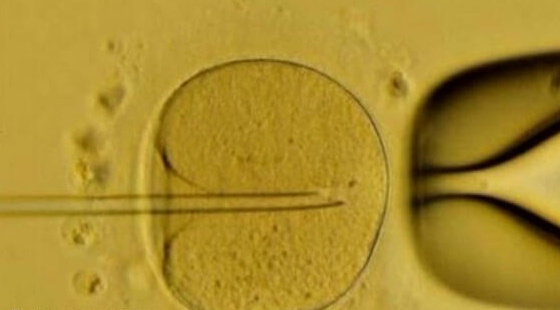 赴美试管反复促排难获优胚：染色体异常或是关键“元凶”