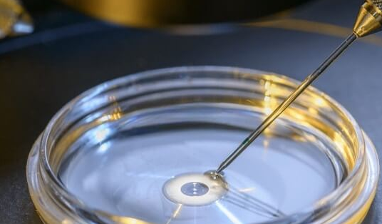 三代试管婴儿PGT筛查：三大结果解析与胚胎整倍体的意义