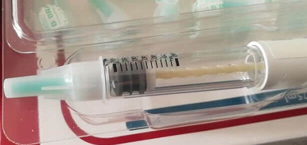 美国试管促排打果纳芬的效果盘点：卵泡数量与个体差异解析