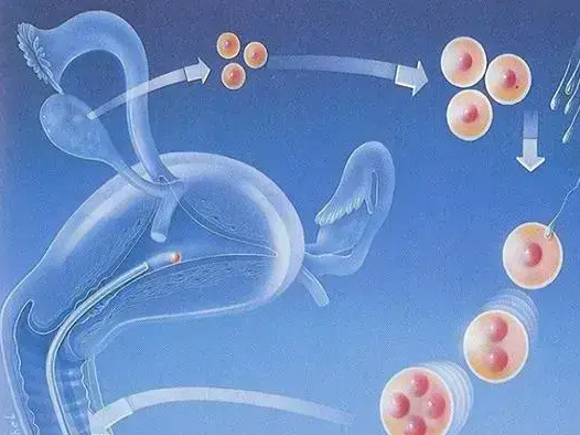 美国试管婴儿移植后常见8种反应