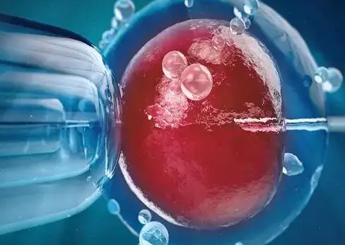 边降调边促排:增加卵泡数量的科学策略