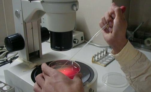 试管婴儿一代、二代、三代对比：技术差异与适用场景全解析