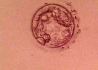 4ab与5ab囊胚质量及移植成功率对比分析