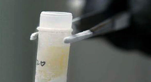 试管婴儿取精前禁欲半个月？取精前要注意哪些事项？