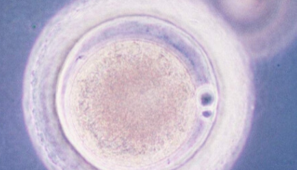 免疫性不孕女性赴美试管婴儿成功率分析