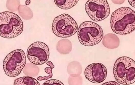 试管婴儿技术为何难以完全筛查掉HLA-B27？