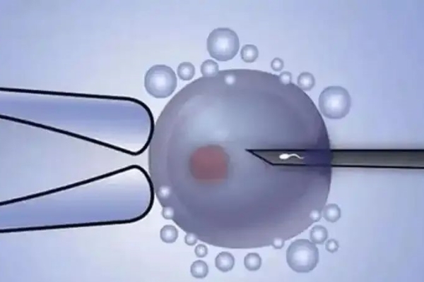 泰国DHC生殖医院：试管取卵后出现腹水是什么原因？