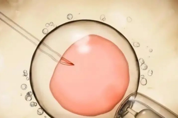 泰国千禧生殖中心：38岁高龄女性也能做试管，做好这些让成功率飙升！