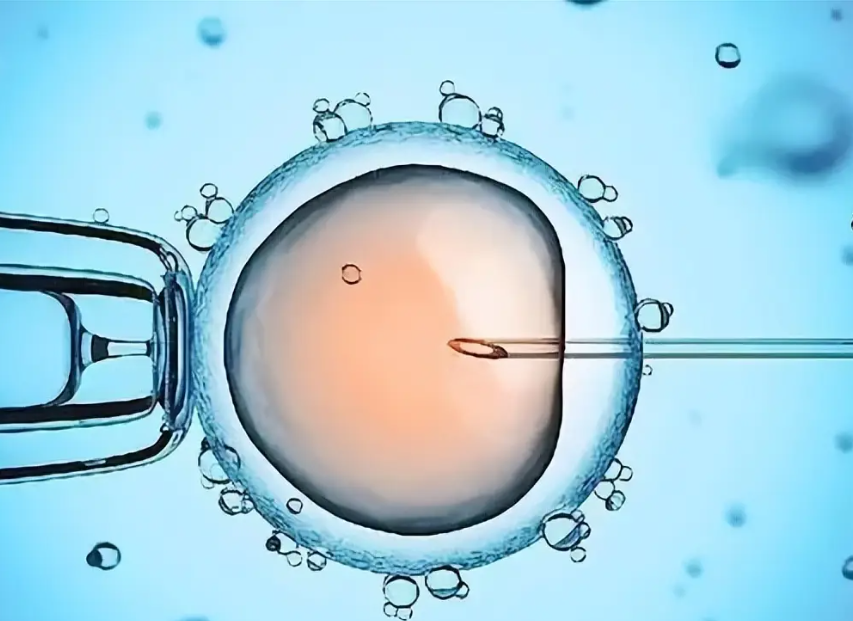 格鲁吉亚universe三代试管婴儿：科学培养优质卵子的全攻略