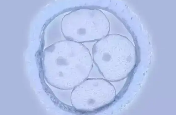 赴美做试管提高成功率的5大方法，调整生活方式是关键一环