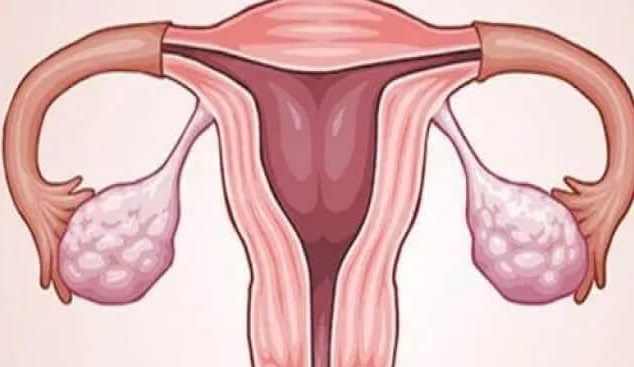 输卵管积水赴泰试管：三代技术精准适配，成功率与优生双保障