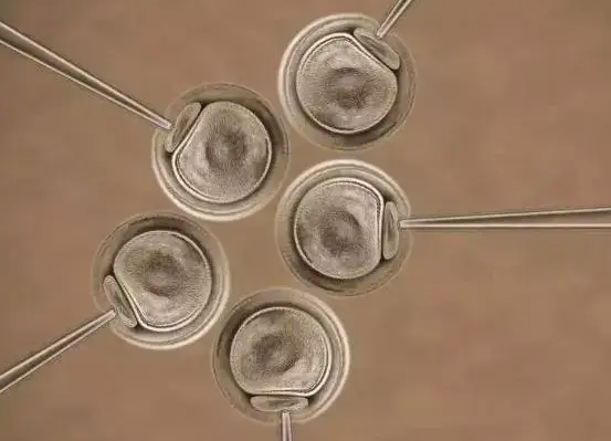 鲜胚移植的条件:内膜厚度是关键,不符则需冷冻胚胎