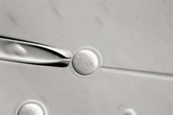 美国试管婴儿全流程攻略：新手入门指南