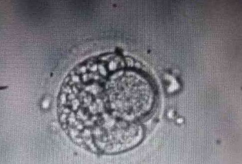 13细胞胚胎质量怎么样?临床统计移植成功率来解答